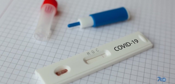 Қашқадарёда қалбаки ПЗР тест тайёрлаб берган шахс ушланди