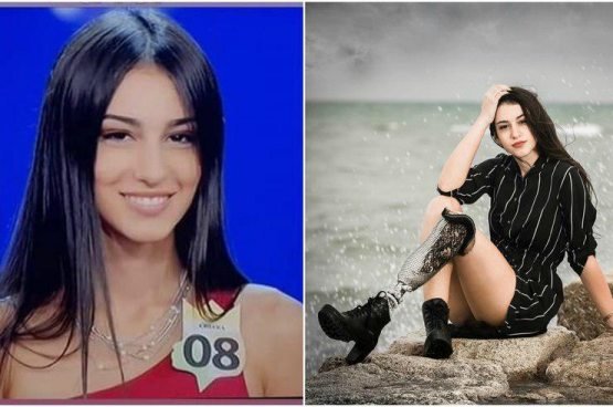 Bir oyog‘i yo‘q qiz “Miss Italiya” go‘zallik tanlovida finalga chiqdi