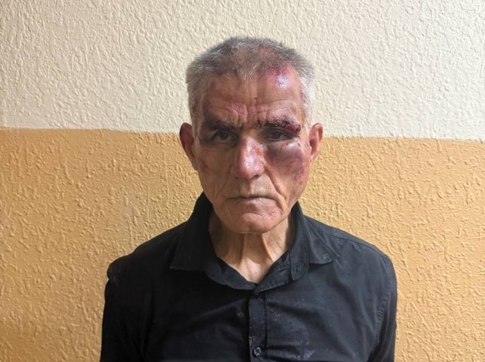 Тошкентда руҳий касал эркак ички ишлар ходимини пичоқлади