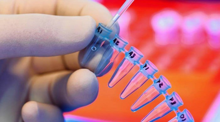 Qashqadaryoda ilk bor oqqonga chalingan bolalarni xalqaro standartlar asosida tashxislash yo‘lga qo‘yildi