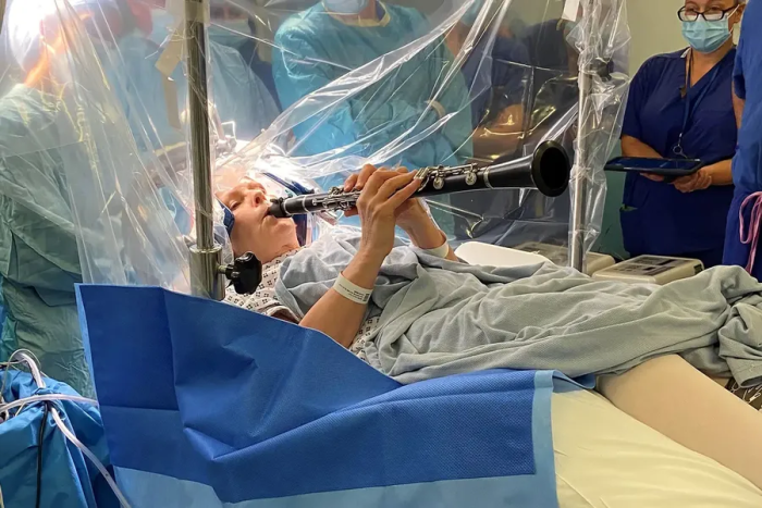 Londonda ayol miya operasiyasi vaqtida musiqa chaldi