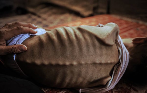 G‘azodagi blokadada 100 nafardan ortiq bola ochlikdan halok bo‘ldi