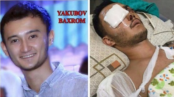 Attraksiondan yiqilib jarohat olgan aktyor Bahrom Yaqubovga 100 mlnga yaqin moddiy zarar undirib berildi