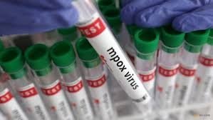 Буюк Британияда хавфли вируснинг янги штамми топилди