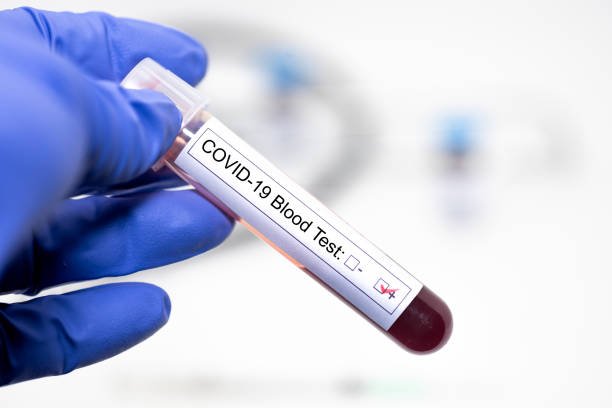 Сингапур ва Гонконгда COVID-19нинг янги тўлқини хавфи тарқалмоқда