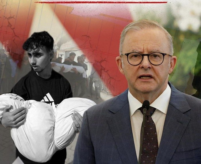 Австралия бош вазири Исроилнинг Ғазо блокадасини ҳеч қандай асосли деб ҳисобламайди