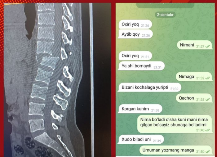 Навоийда эркак алимент талаб қилган хотинини машинада босиб кетди, аёлнинг умуртқаси синди