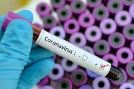 Tojikistonda 3 kishi vafot etdi, yana 102 kishida koronavirus aniqlandi
