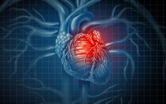 Қалб қорайишига сабаб бўлувчи омиллар