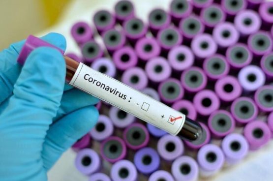 Вирус симптомлари бўлмаган инсонлар COVID-19 ни юқтириши мумкинми?