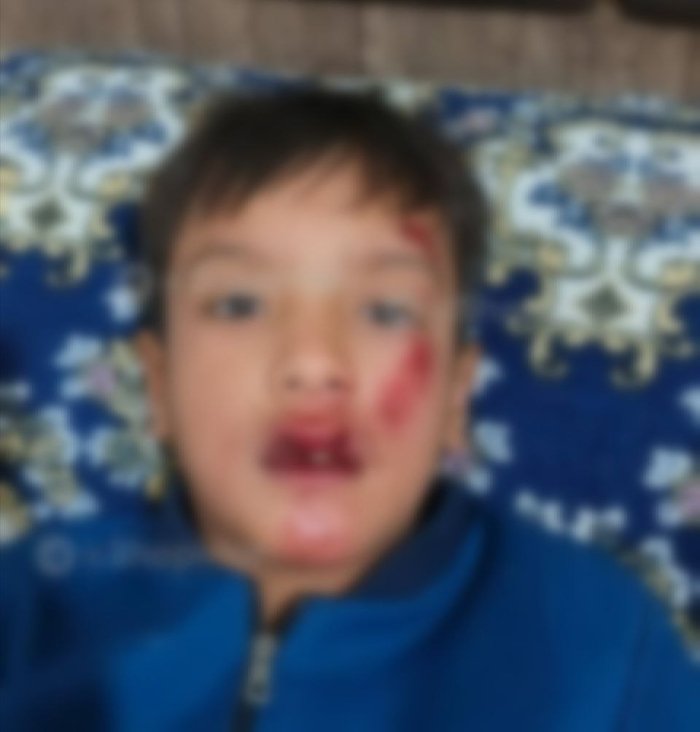 9-sinf o‘quvchisi o‘zidan 6 yosh kichik 3-sinf o‘quvchisini beayov kaltaklagani aytilmoqda 