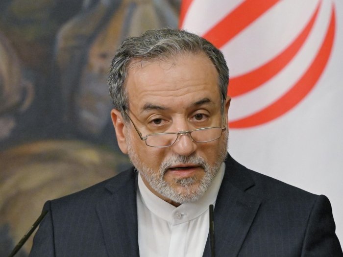 Eron oliy rahbarining salomatligi haqida xabar berildi