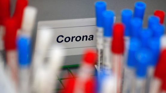 O‘zbekistonda koronavirus: resurslar poyoniga yetdi, shifoxonalar to‘lgan