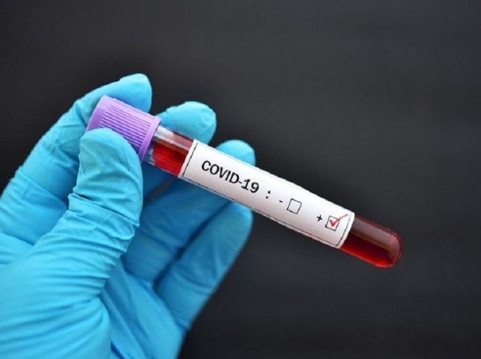 Тожикистонга коронавирусга қарши 2,5 миллион доза вакцина етказиб берилди