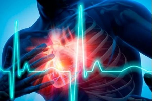 Infarkt va insultga qarshi kurashish milliy dasturi joriy etiladi