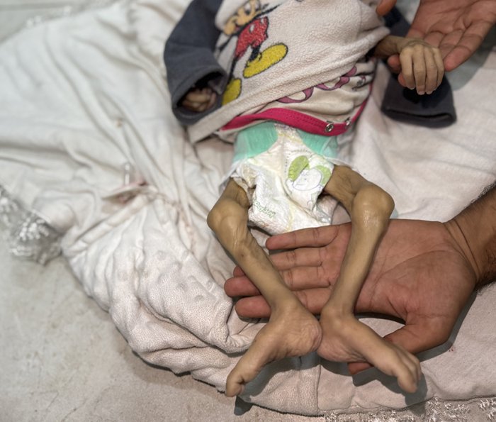 Ғазода очликдан ҳалок бўлганлар сони 180 нафарга етди