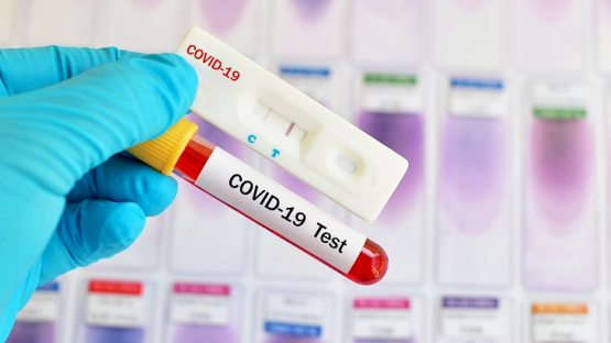 Dunyoda ilk bor koronavirusni aniqlaydigan genetik test ixtiro qilindi