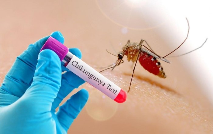 Ekspertlar Yevropaning 29 mamlakatida chikungunya virusi tarqalishi xavfidan ogohlantirdi