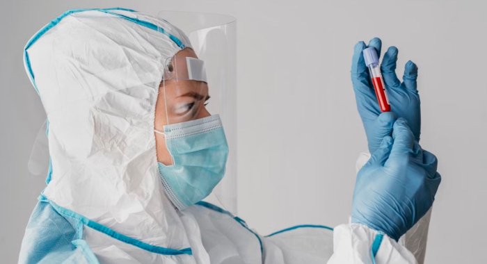 Chikungunya - kovid kabi emas, u O‘zbekistonga kirib kelmaydi