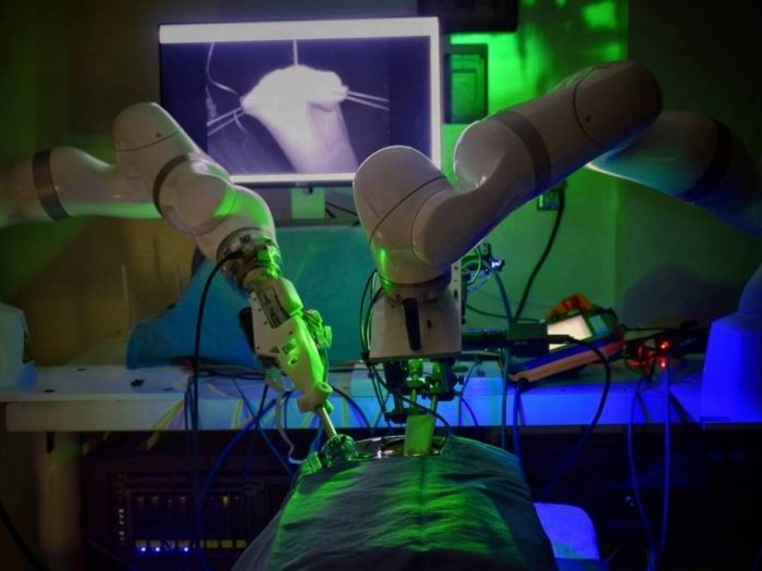Robot-jarroh birinchi marta murakkab operasiyani inson ko‘rsatmasisiz amalga oshirdi