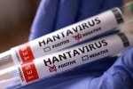 Isroilda hantavirus bilan kasallanishning ilk holati aniqlandi