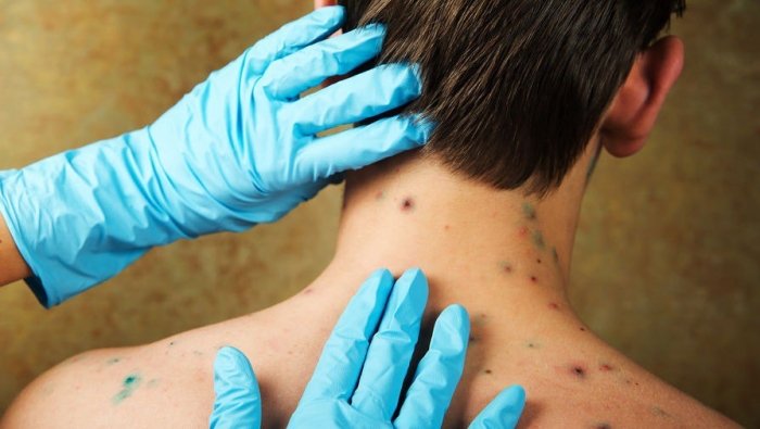 Yalangoch klitoris fotosurati