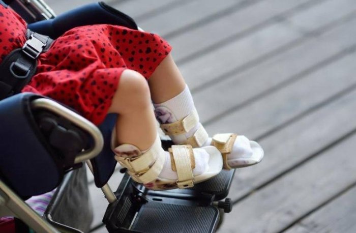 Спинал мушак атрофияси ташхиси қўйилган болалар уйда даволаниш учун зарур жиҳозлар билан таъминланади