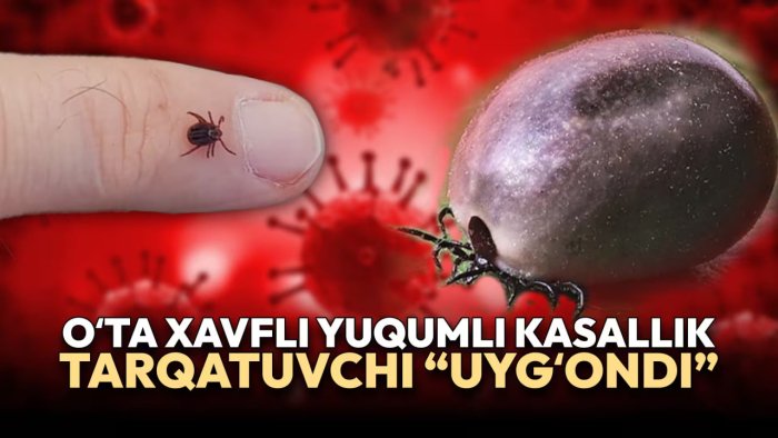 Ўзбекистонда ўта хавфли юқумли касаллик тарқатувчи “уйғонди”